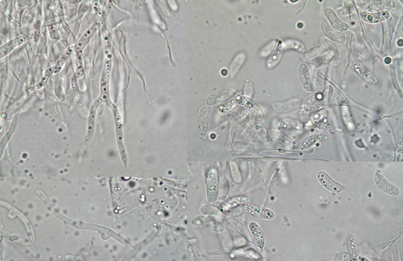 Cerinomyces lipoferus micro